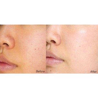 [DongSung Rannce] Serum nám 45ml