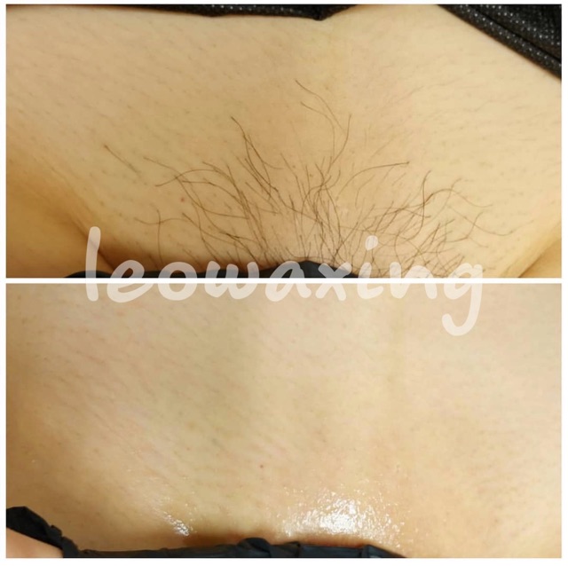 [Mã COS2704 giảm 8% đơn 250K] 100ml MỠ TRĂN NGUYÊN CHẤT TRIẾT ỐNG BÓP NHỎ GIỌT | BigBuy360 - bigbuy360.vn