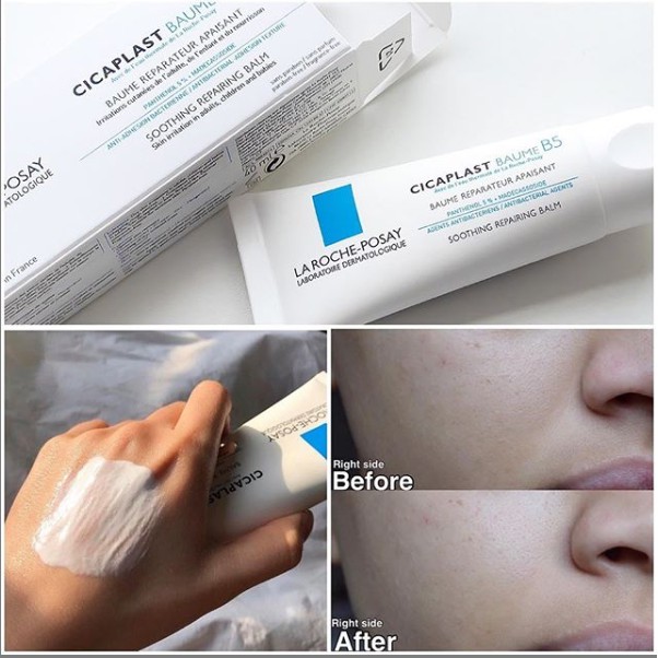 Kem dưỡng La Roche Posay Cicaplast Baume B5