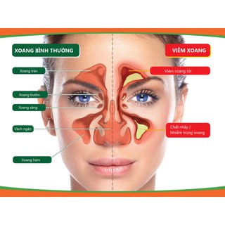 Bình Rửa Mũi Nasal Rinse (Bình + 10 Gói Muối)