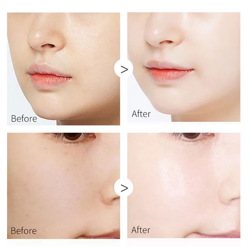 Viên Nang Polypeptide Thời Gian Phục Hồi Làn Da Dưỡng Ẩm Thu Nhỏ Lỗ Chân Lông Làm Sáng Tông Màu Da