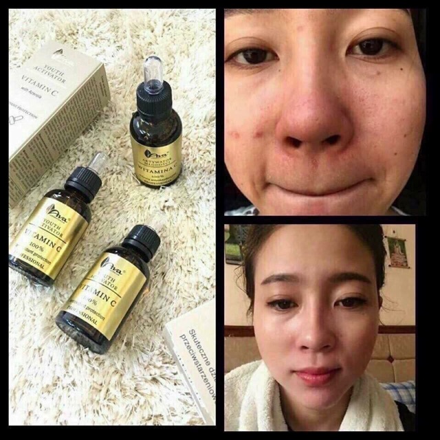 Serum Vitamin C