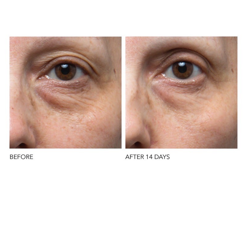 Serum mắt Dr. Dennis Gross Skincare Ferulic + Retinol Triple Correction Eye Serum giảm nhăn, bọng và săn da mắt | BigBuy360 - bigbuy360.vn