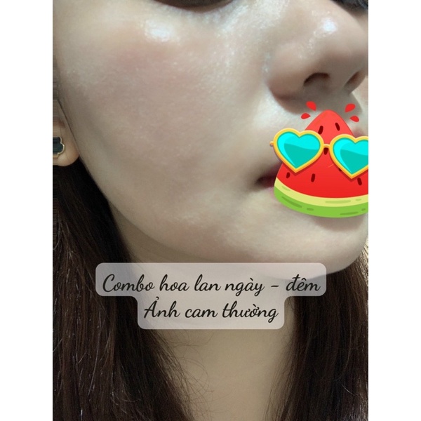 Kem Hoa Lan Hồng - San RuBy - mẫu mới 2023