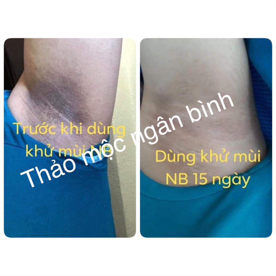 Thảo dược khử mùi hôi nách hồng, khử mùi hôi nách hôi chân, khử thâm nách, đen nách, se lỗ chân lông .....