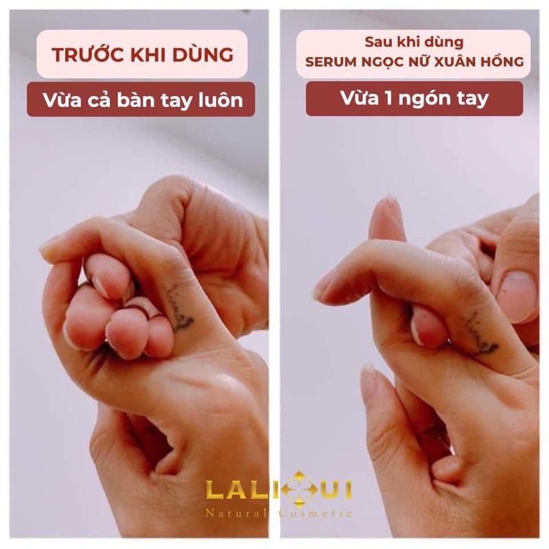 DUNG DỊCH VỀ SINH NGỌC NỮ XUÂN HỒNG LALIHUI