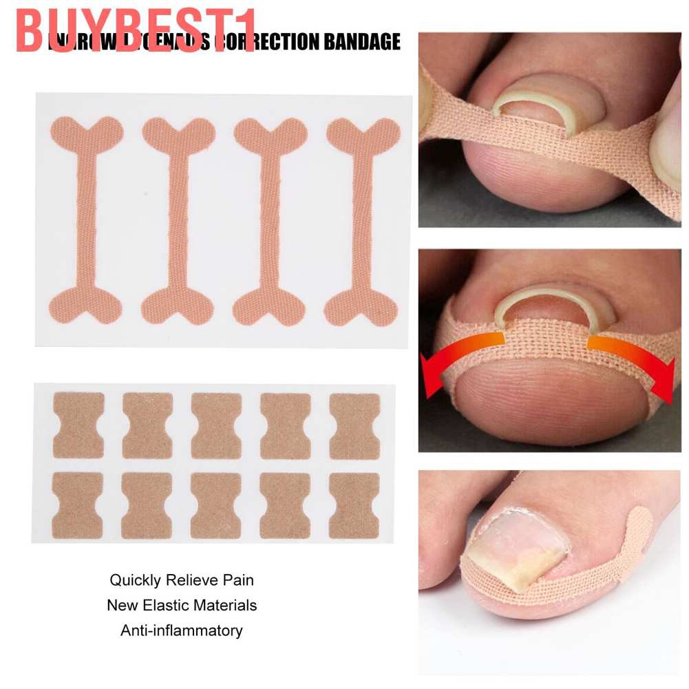 (Hàng Mới Về) Set 13 Miếng Dán Chỉnh Hình Móng Chân Tiện Dụng | BigBuy360 - bigbuy360.vn