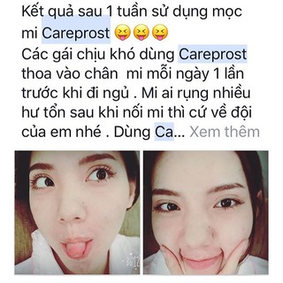 THUỐC KÍCH MỌC DÀI MI CAREPROST