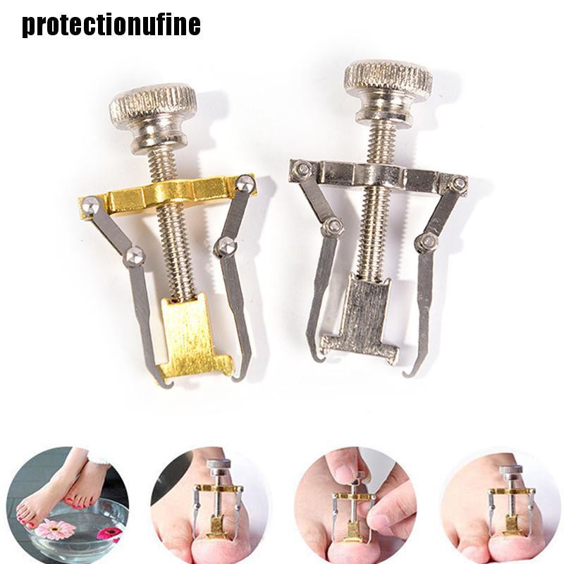 Dụng Cụ Định Hình Chỉnh Hình Móng Chân Mọc Ngược Chuyên Nghiệp