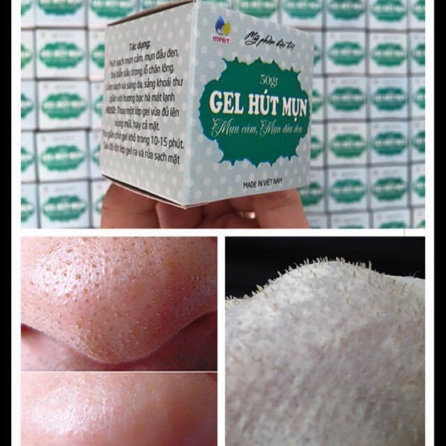 Gel hút mụn bạc hà