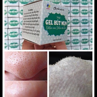 Gel hút mụn bạc hà