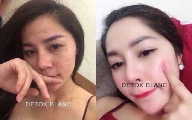 Mặt Nạ Thải Độc Trắng Da DETOX BLANC ( Cam Kết Chính Hãng) | BigBuy360 - bigbuy360.vn