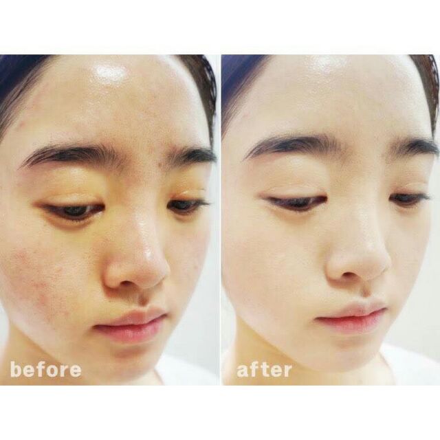 Serum AHC xách tay chuẩn Hàn Quốc luôn nhé