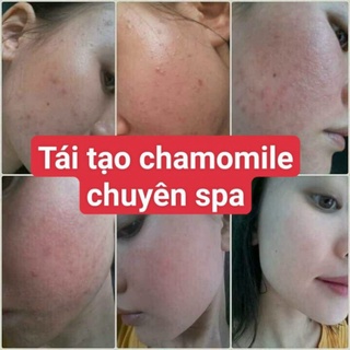 Kem tái tạo Chamomile hồng sâm