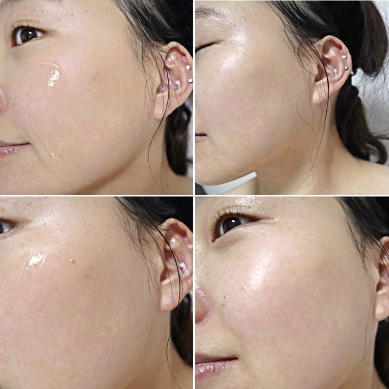 Kem Dưỡng DERLADIE Witch Hazel Perfect Vitamin Gel Cream Ngừa Mụn, Giảm Thâm, Làm Đầy Sẹo Rỗ 55ml