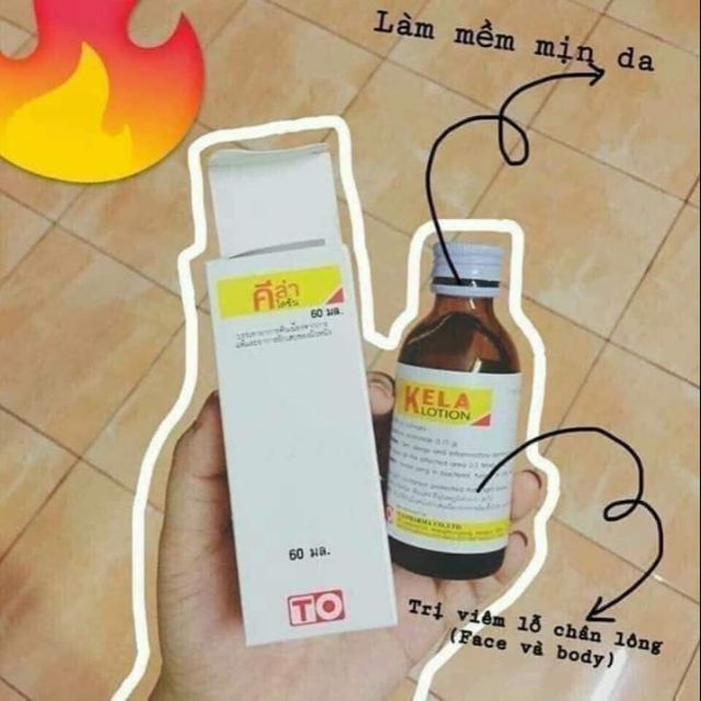 KELA LOTION VIÊM LỖ CHÂN LÔNG