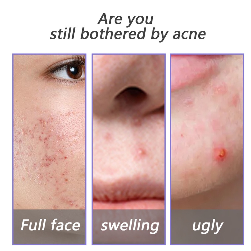 Xà Phòng Hoa Oải Hương Tự Nhiên Tẩy Tế Bào Chết Dưỡng Ẩm Sâu Cho Da