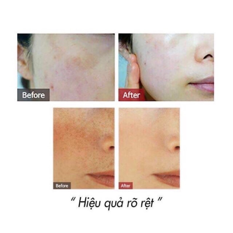 [MẪU MỚI 40ML] Kem nám Melasma-X 3D Whitening Clinic Renewal Cream Hàn Quốc