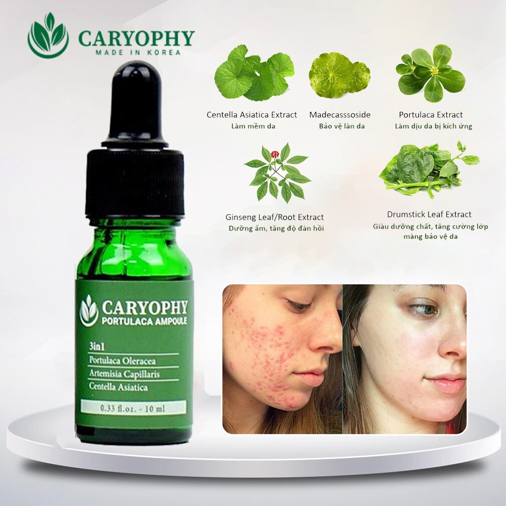 Serum Giảm Mụn Mờ Thâm Sáng Da Caryophy 10ml