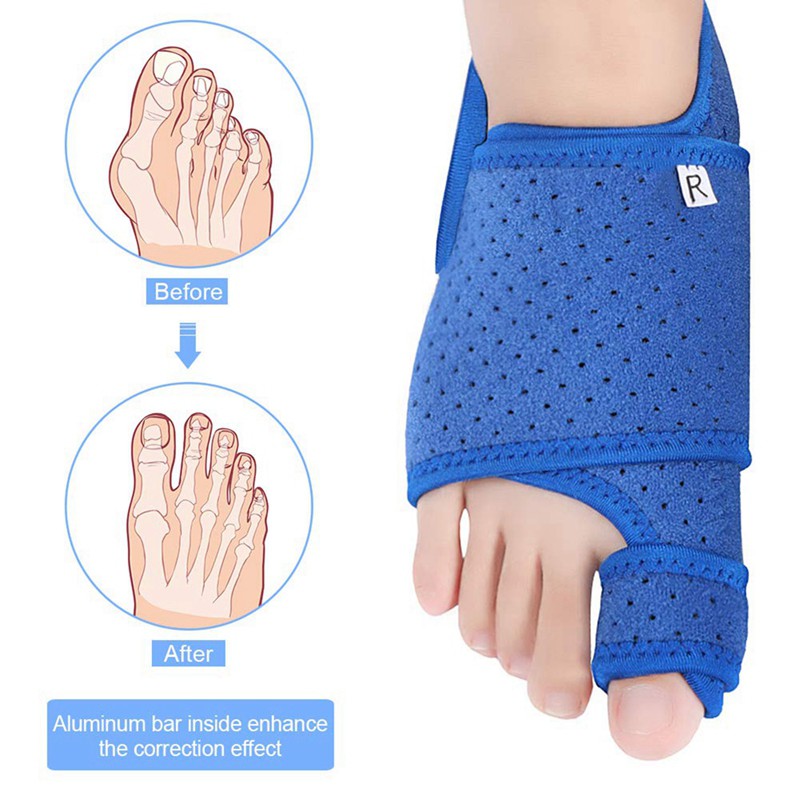 Đai nẹp chỉnh hình bàn chân chất lượng cao cho nam và nữ
