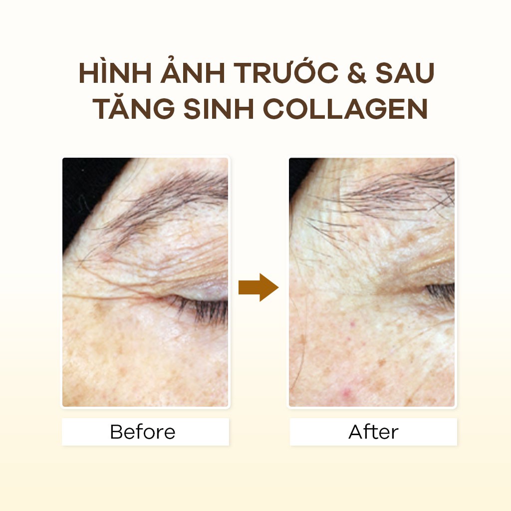 Bộ Đôi Phục Hồi Chuyên Sâu Tái Tạo Da Zakka Naturals 4 | BigBuy360 - bigbuy360.vn