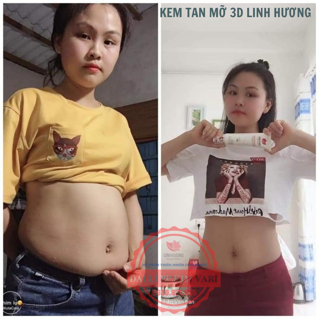 Kem Tan Mỡ 3D Linh Hương - Giảm 4 ~ 10cm vòng bụng/1 liệu trình - Chiết xuất gừng, quế - Giảm mỡ bụng tại nhà