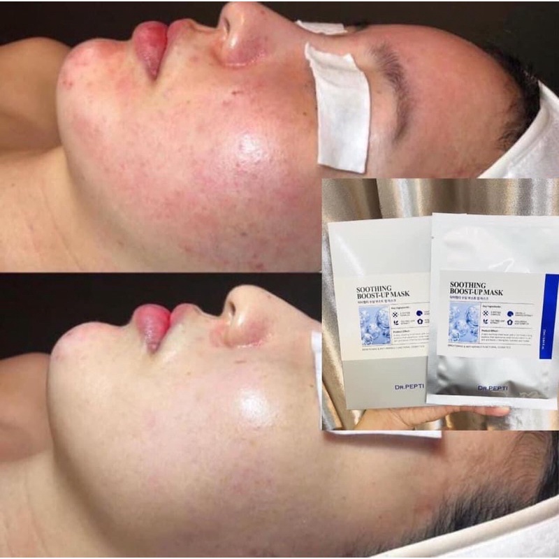 Mask Dr Pepti - Mặt Nạ Dr Pepti hộp 5m