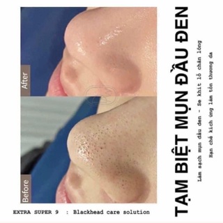 Medipeel extra 9+