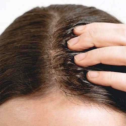 Serum dưỡng tóc The Ordinary Multi-Peptide Serum for Hair Density