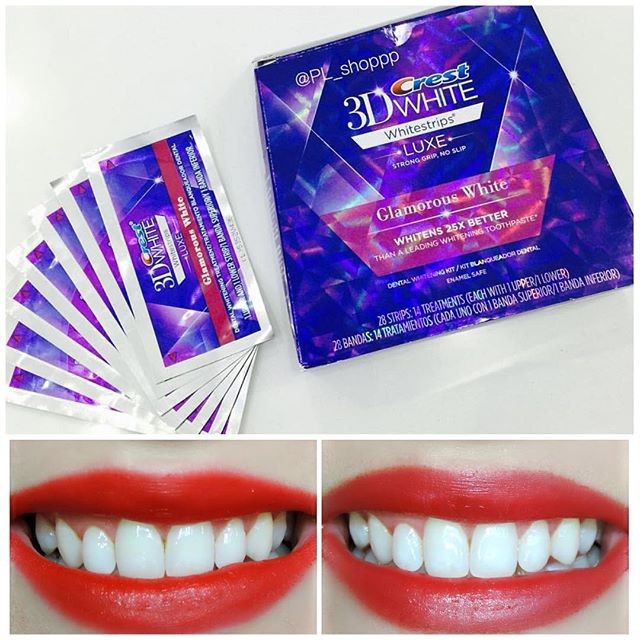 Miếng dán trắng răng Crest 3D White