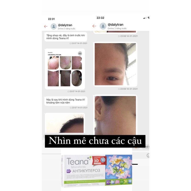Serum Teana A1 A3 cho da yếu mỏng, giãn nổi mao mạch dưới da | BigBuy360 - bigbuy360.vn