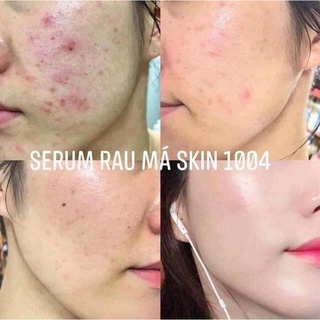 Tinh chất rau má Centella