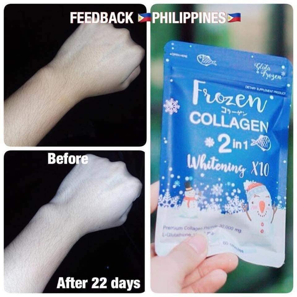 Nội Địa Thái | 60 Viên Uống Trắng Da Frozen Thái Lan