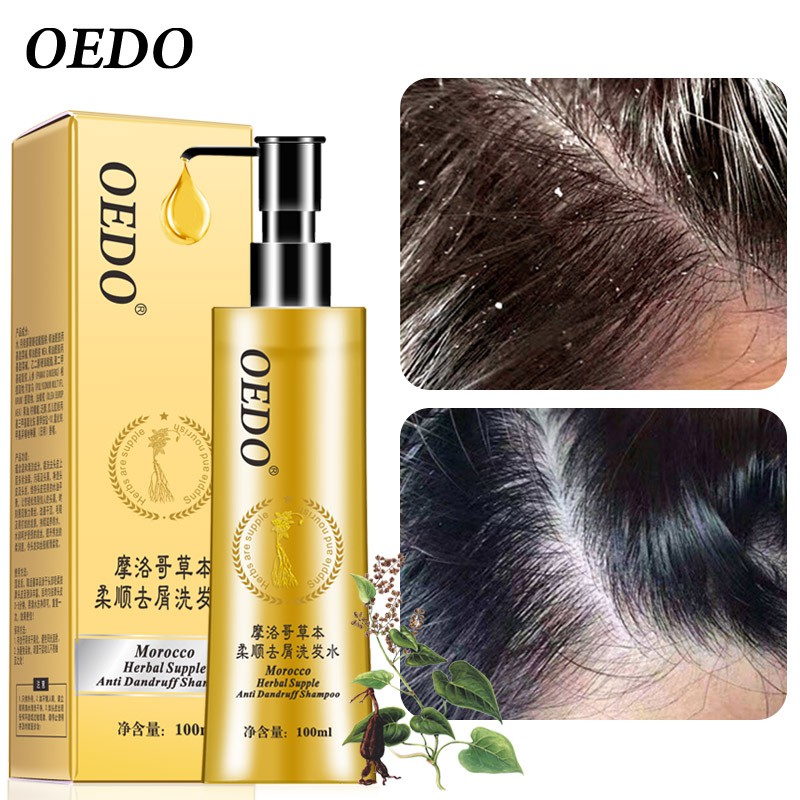 Dầu gội dược liệu chống gàu OEDO Ngát hương hoa phù hợp với da đầu dầu giảm rụng tóc giúp mọc tóc suông mượt 100ml