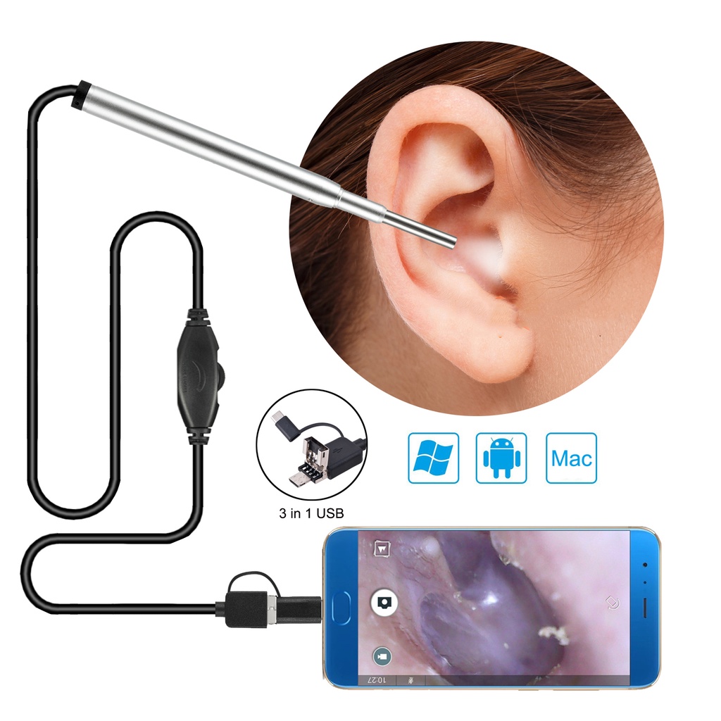 Camera Nội Soi Tai mũi họng Siêu Nét, Camera Nội Soi Lấy Ráy Tai, An toàn cho bé, Kết nối Androi dưới 10.