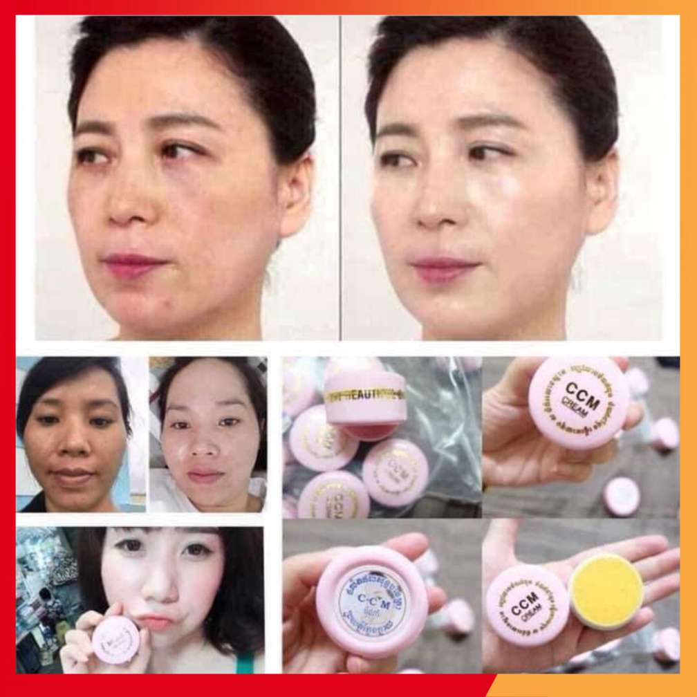 Kem Xóa Nám CCM Cream Thái Lan