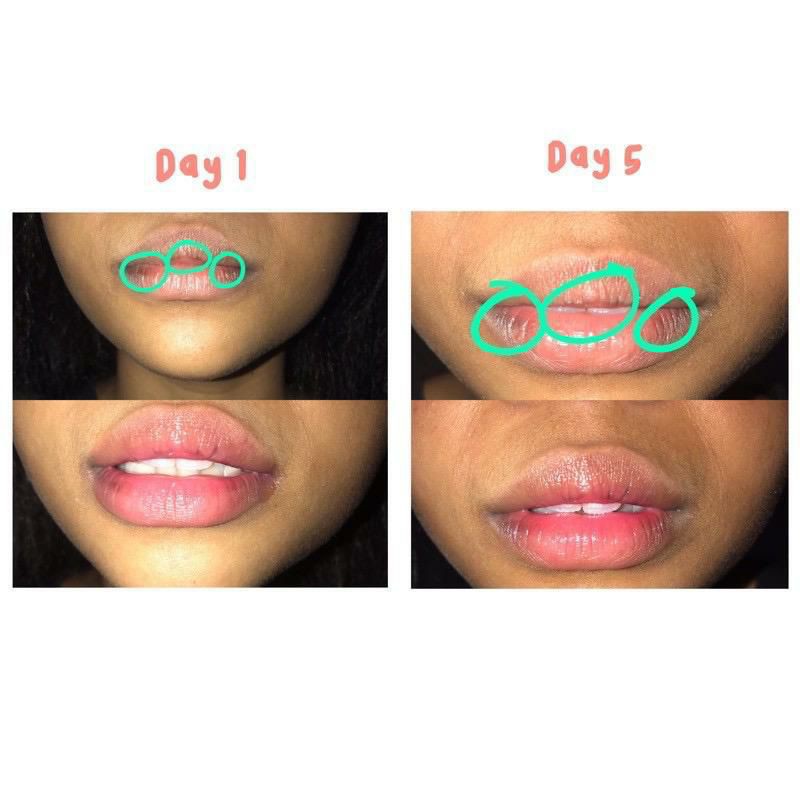 (Hàng Mới Về) Serum Dưỡng Môi Beautetox Hello Papa | BigBuy360 - bigbuy360.vn