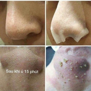 DUNG DỊCH Ủ MỤN MEDIPEEL 250ml