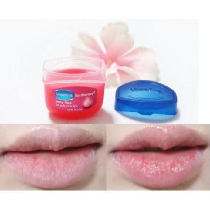 Son Dưỡng Môi Vaseline Lip Therapy 7g Dạng Sáp