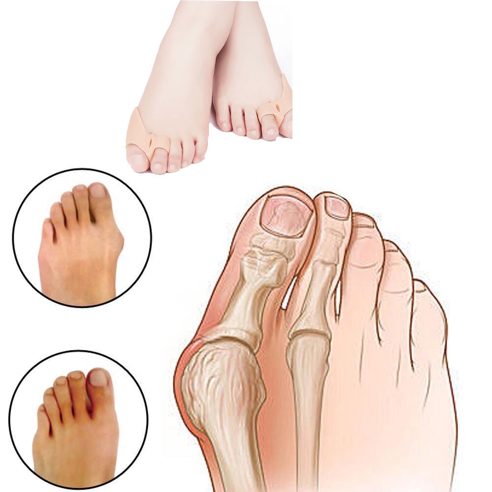 Dụng Cụ Tách Ngón Chân Cái Bằng Silicon, Tách Ngón Chân Cái Silicon