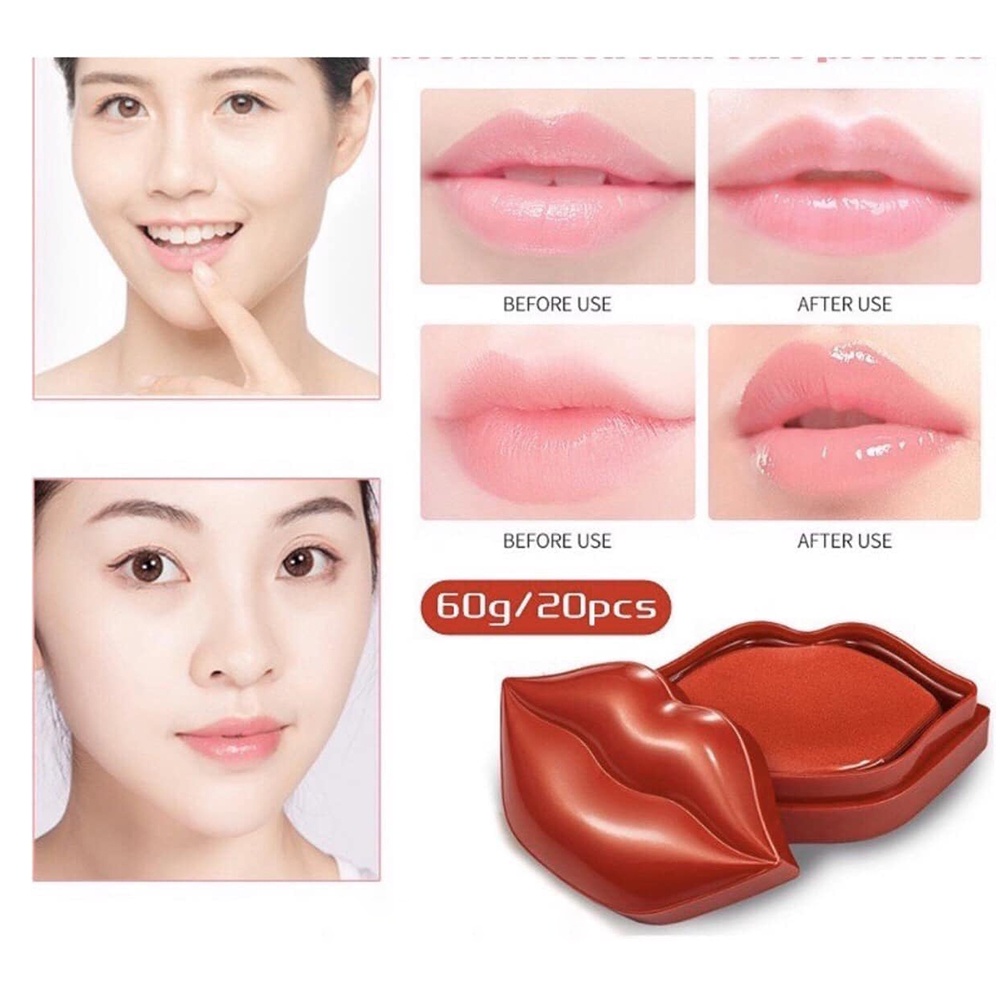 Hộp 20 miếng - MẶT NẠ DƯỠNG HỒNG MÔI - Hàng chính hãng