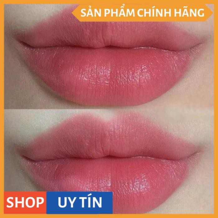 SON Ủ MÔI SHI - MỀN MÔI -DƯỠNG MÔI - HỒNG MÔI - TRỊ THÂM MÔI V V V | Thế Giới Skin Care