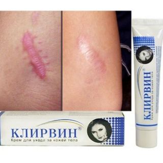 {CHINH HANG }} Kem Xóa Mờ Sẹo Thâm- Sẹo Mụn  Cao Cấp