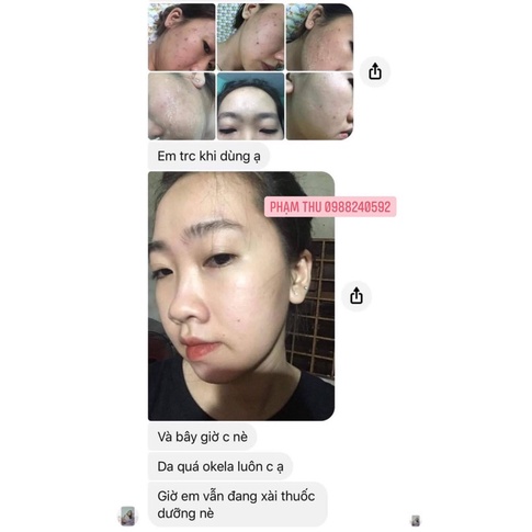Thuốc bắc tái tạo da mụn nám, sạch mụn nám