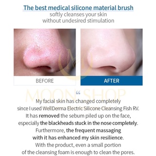 Máy rửa mặt WELLDERMA