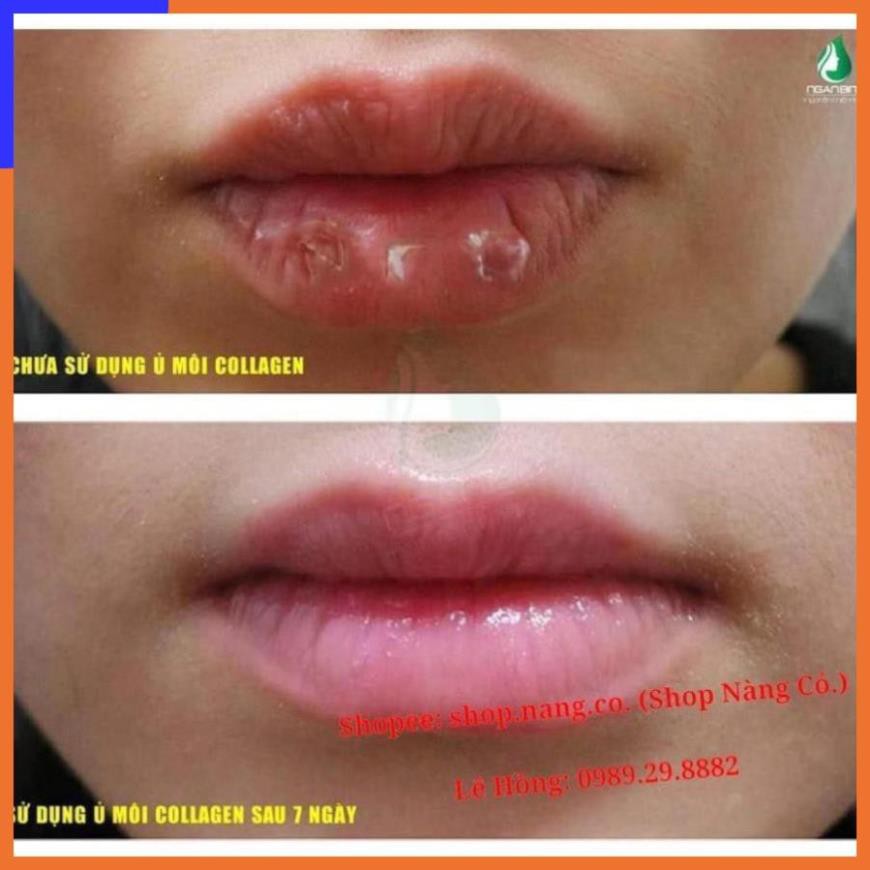 Son dưỡng môi SHI - Mền Môi- dưỡng collagen - hồng môi [ hàng mới về] V V V | BigBuy360 - bigbuy360.vn