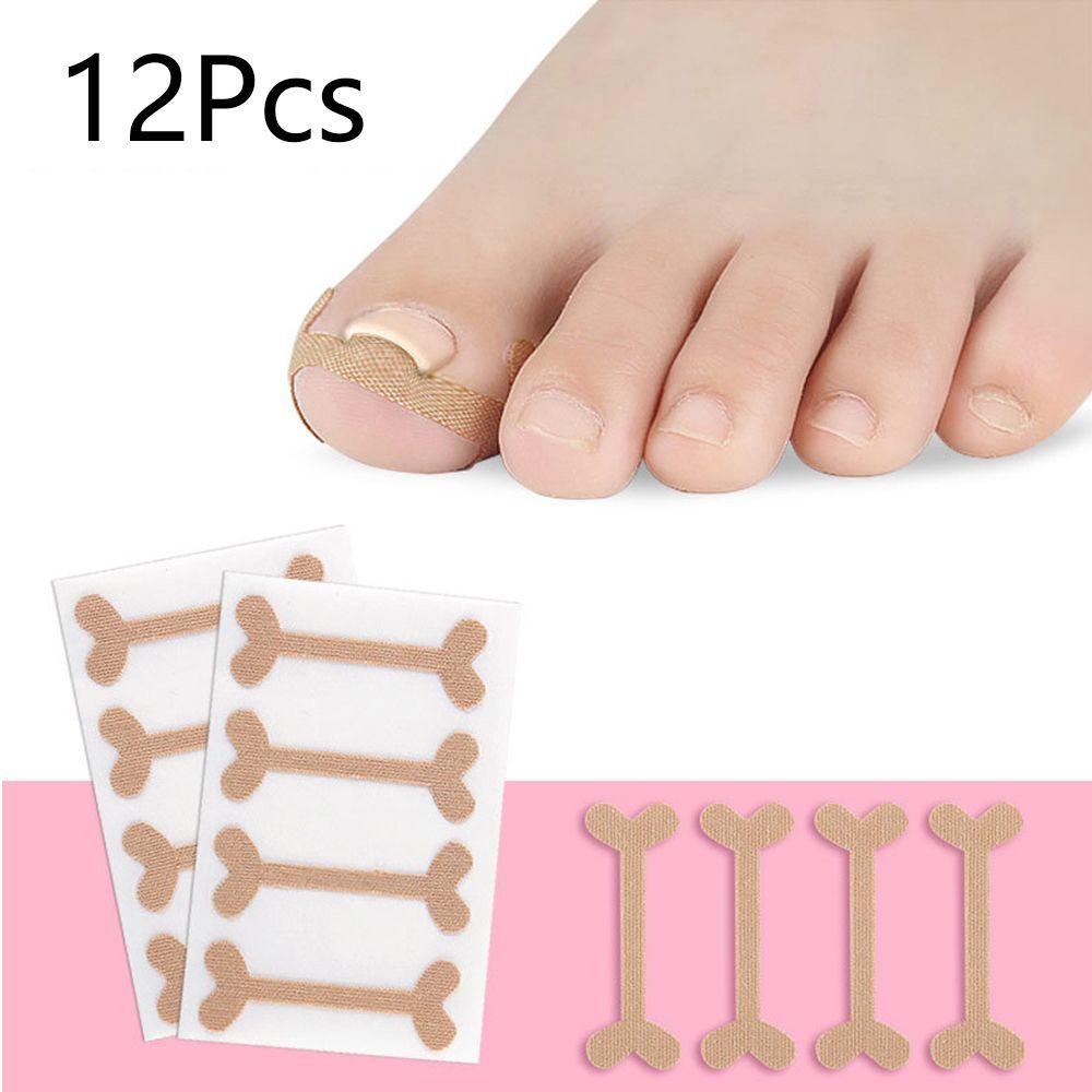 Miếng Dán Điều Chỉnh Móng Chân Mọc Ngược Tiện Dụng