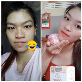 1bộ collagen plus vit e