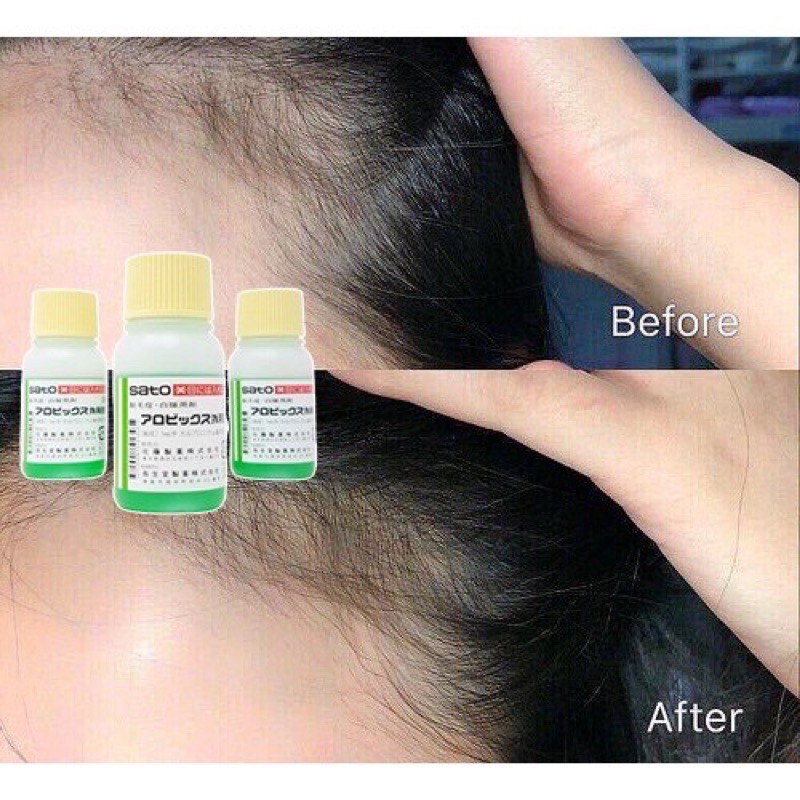 Tinh chất mọc tóc Sato (30ml) | BigBuy360 - bigbuy360.vn