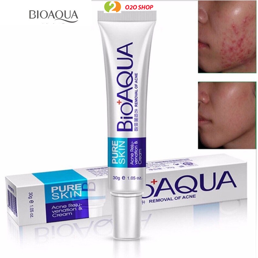 Kem Khử Mụn Bioaqua Pure Skin Giảm Thâm, Đánh Bay Mụn Chỉ Trong Vài Ngày O2O Shop